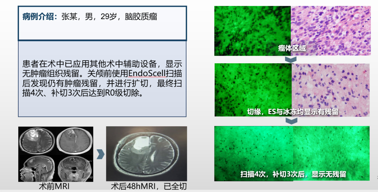 神经外科(图1)