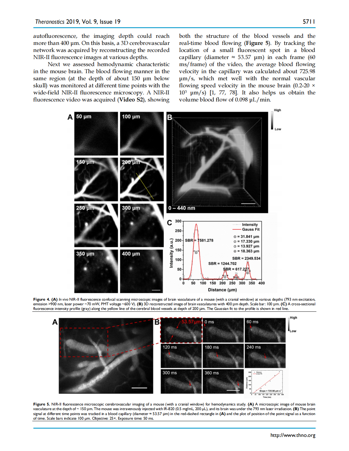 Excretable IR-820 for in vivo NIR-II fluorescence cerebrovascular imaging and photothermal therapy of subcutaneous tumor(图6)