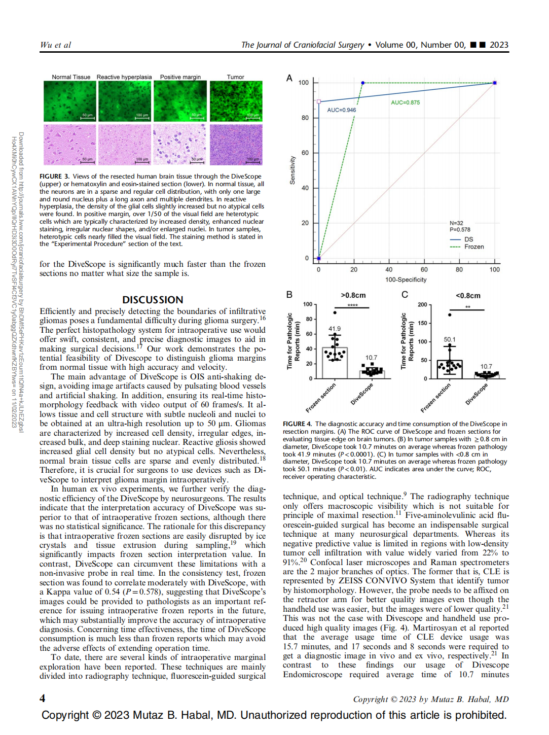 Application of a Novel Miniaturized Histopathologic Microscope for Ex Vivo Identifying Cerebral Glioma Margins Rapidly During Surgery: A Parallel Control Study(图4)