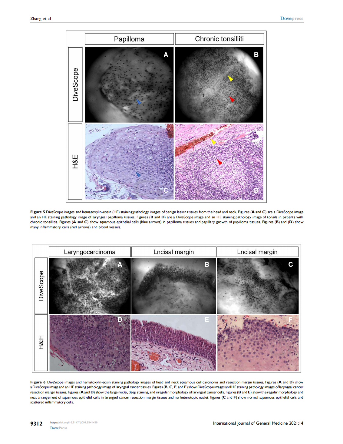 A Novel Cell Morphology Analyzer Application in  Head and Neck Cancer(图6)