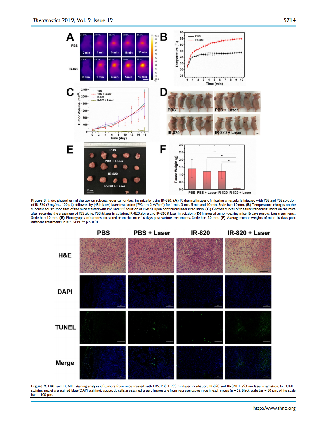 Excretable IR-820 for in vivo NIR-II fluorescence cerebrovascular imaging and photothermal therapy of subcutaneous tumor(图9)