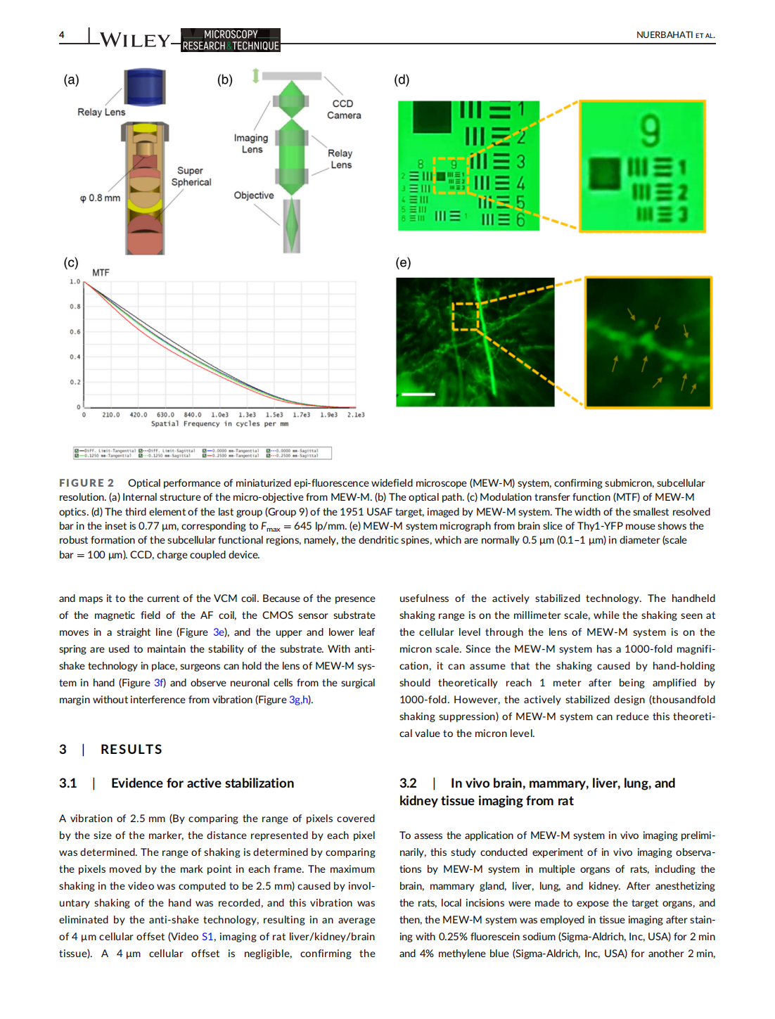 An actively stabilized, miniaturized epi-fluorescence widefield microscope for real-time observation in vivo(图4)