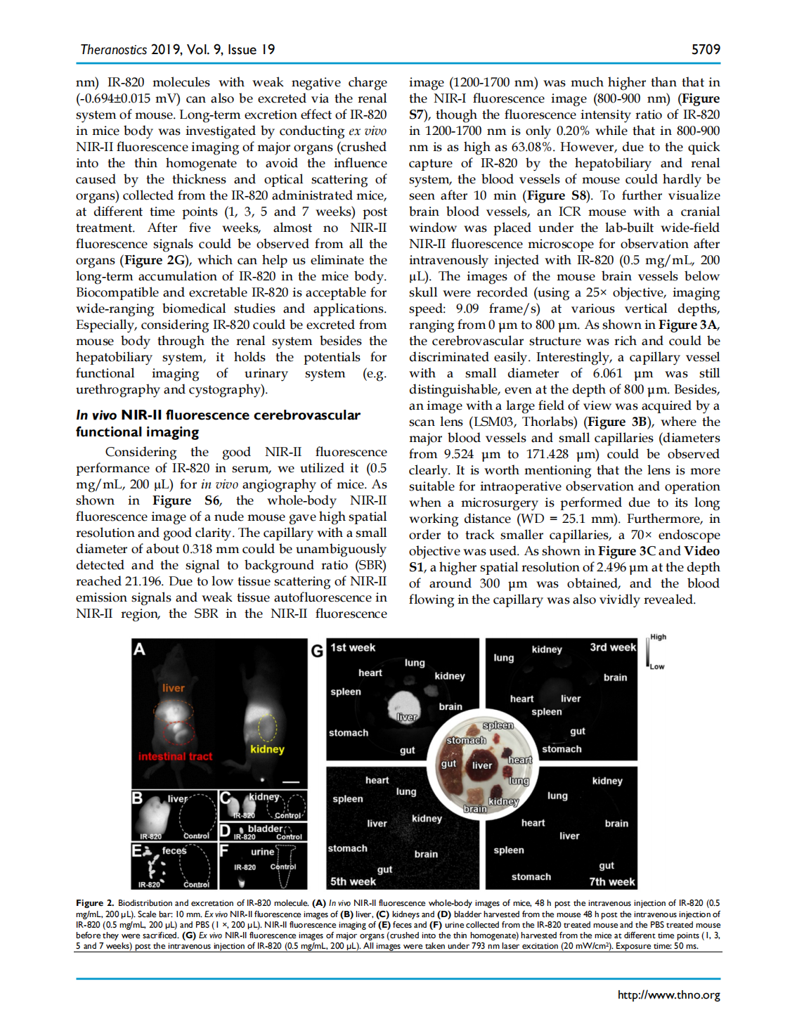 Excretable IR-820 for in vivo NIR-II fluorescence cerebrovascular imaging and photothermal therapy of subcutaneous tumor(图4)