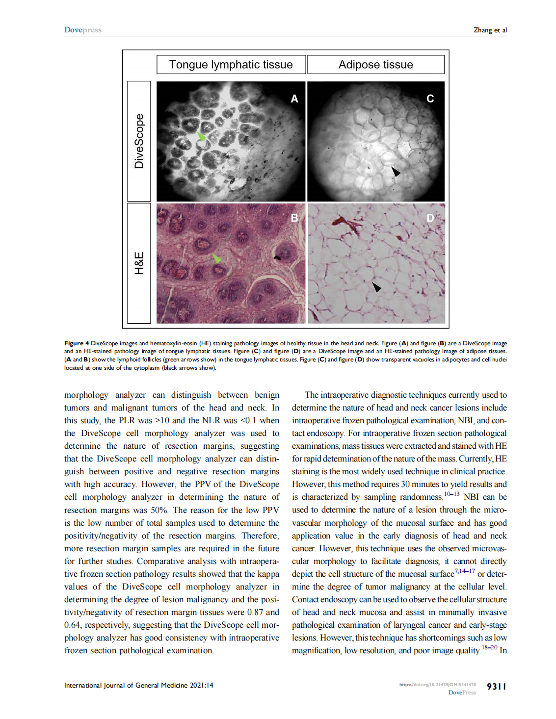 A Novel Cell Morphology Analyzer Application in  Head and Neck Cancer(图5)