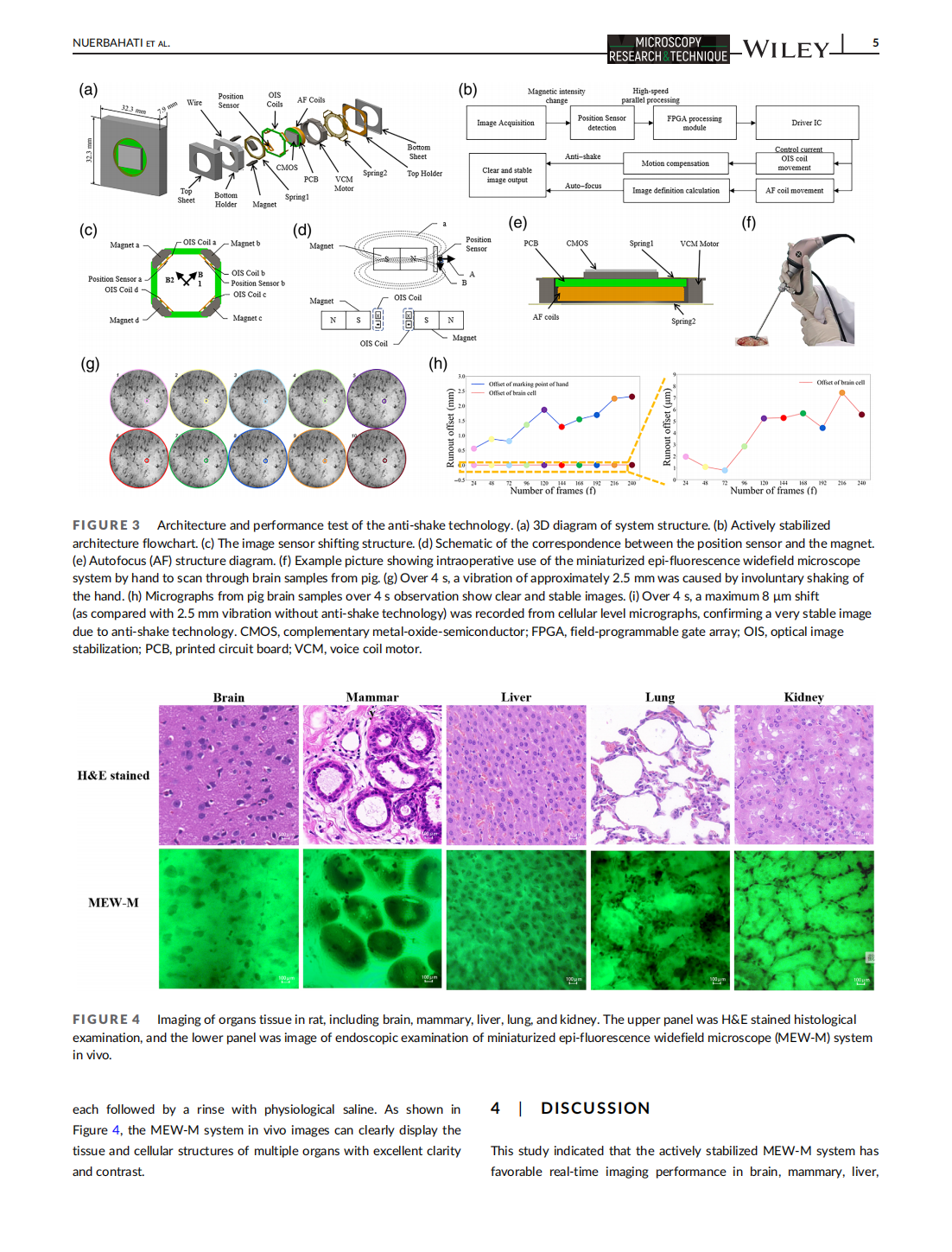 An actively stabilized, miniaturized epi-fluorescence widefield microscope for real-time observation in vivo(图5)