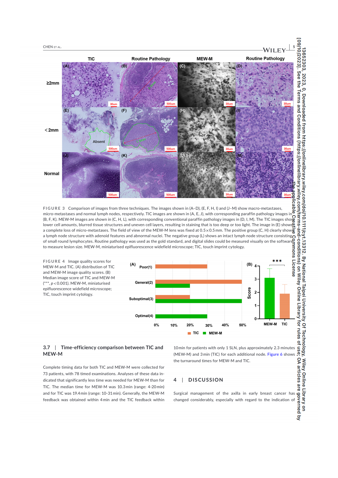 A prospective comparison of a modified miniaturised hand-held epifluorescence microscope and touch imprint cytologyfor evaluation of axillary sentinel lymph nodes intraoperativelyin breast cancer pati(图5)