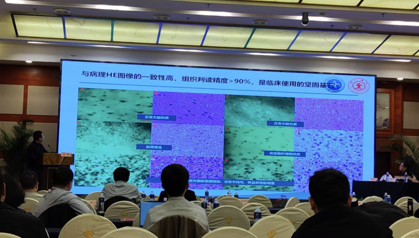 昆明神经肿瘤论坛：EndoSCell®细胞级荧光导引技术开启精准手术新时代(图4)