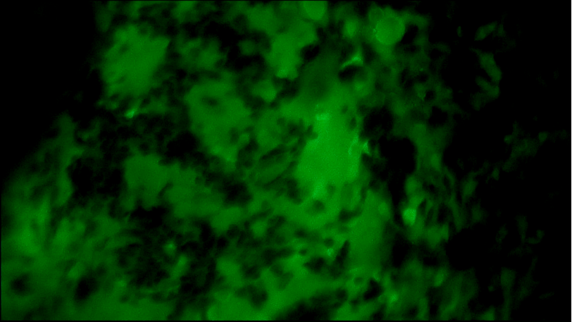 EndoSCell®助力邢台市人民医院成功完成首例乳腺肿瘤细胞级精准切除手术(图2)